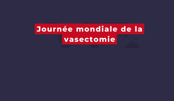 vasectomie